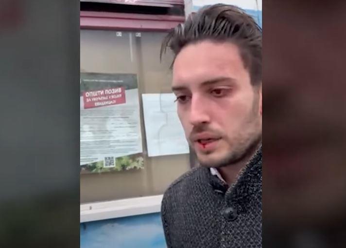Нова.рс: Во Земун физички нападнат Павле Грбовиќ