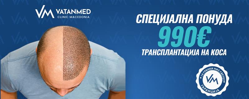 Трансплантација на коса по супер цена од 990 евра