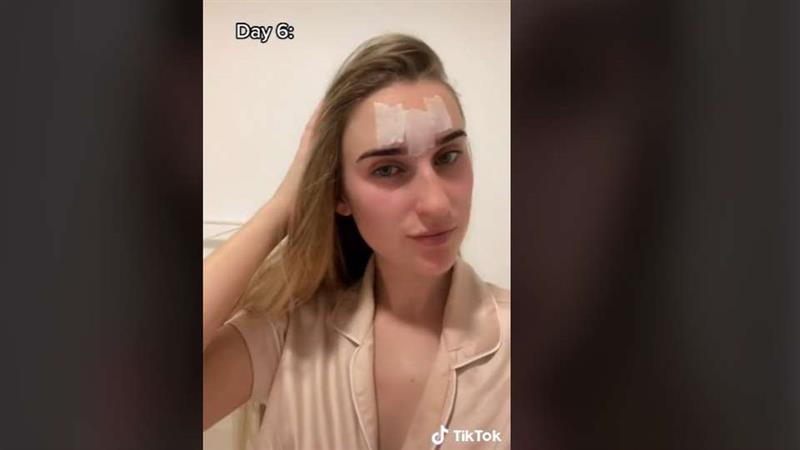 Селотејп за бришење брчки?! Бизарен тренд или навистина ефикасно?