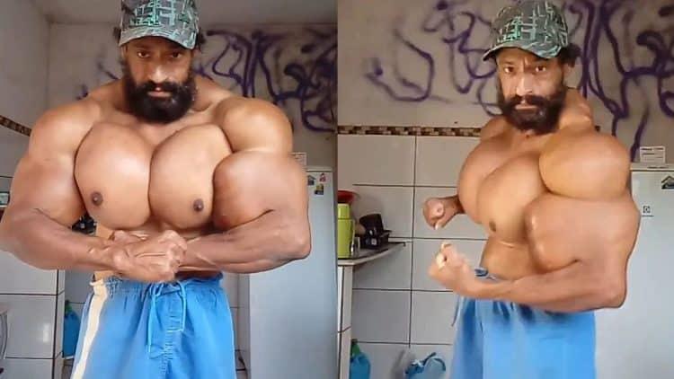 Почина „Бразилскиот Хулк”, ги пумпал мускулите со отровни инекции (ФОТО)