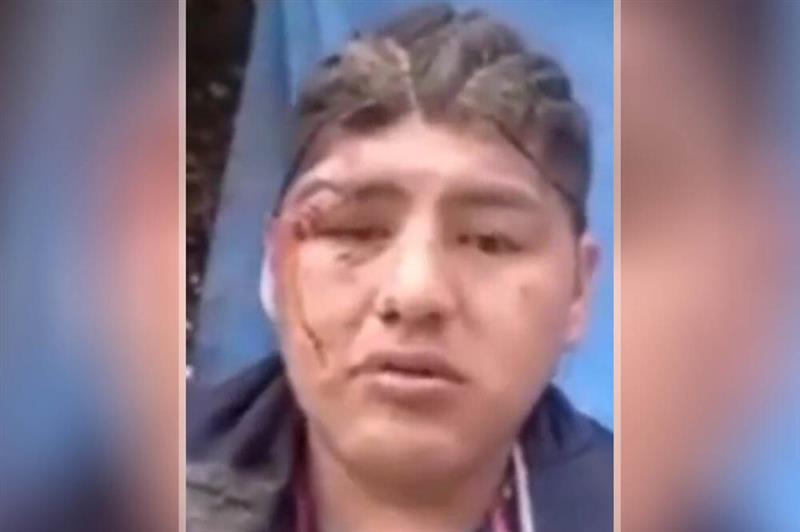 Се испијанил на фестивал, па жив го погребале- се разбудил во ковчег (ВИДЕО)