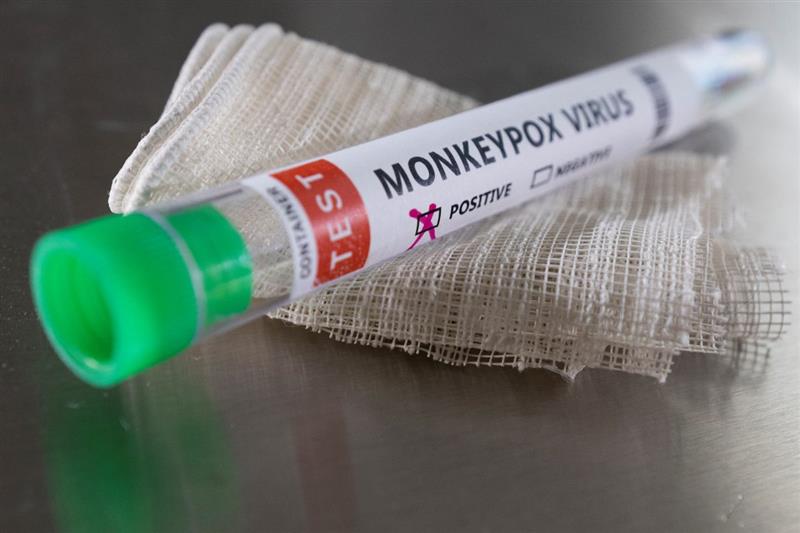 Прв смртен случај од мајмунски сипаници во САД 