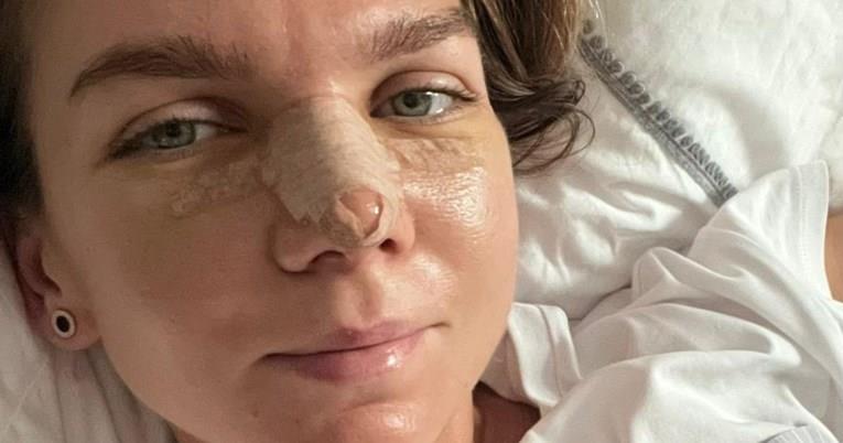 Врвна тенисерка го оперира носот и ги пропушта натпреварите, претходно „ги среди“ градите 