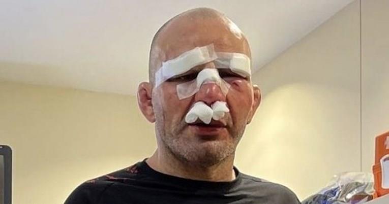 Менаџер на борец, претепан на натпревар: Не му е ништо 