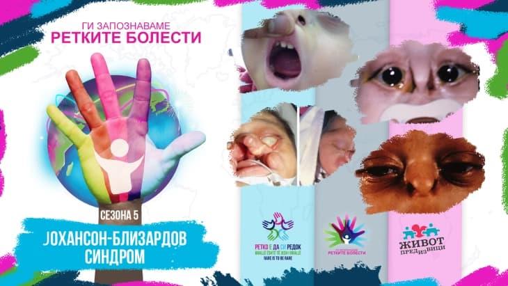 „Ги запознаваме ретките болести 2023“: Јохансон-Близардов синдром