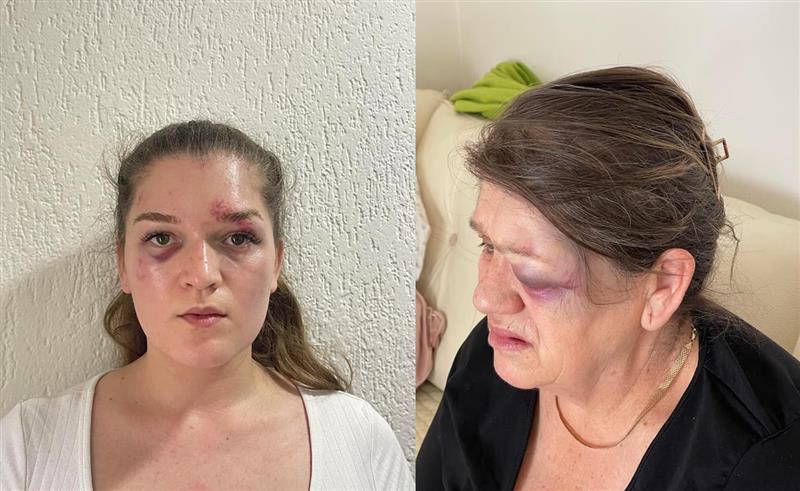 Самохрана мајка и нејзината ќерка со години претепувани од соседот, никој не презема ништо
