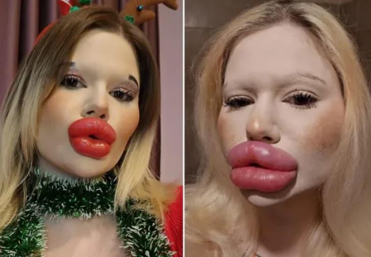 Бугарка има најголеми усни на светот, но не сака да запре (ВИДЕО)