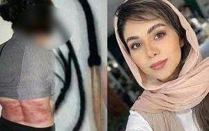 Иранка камшикувана 74 пати затоа што одбила да носи хиџаб