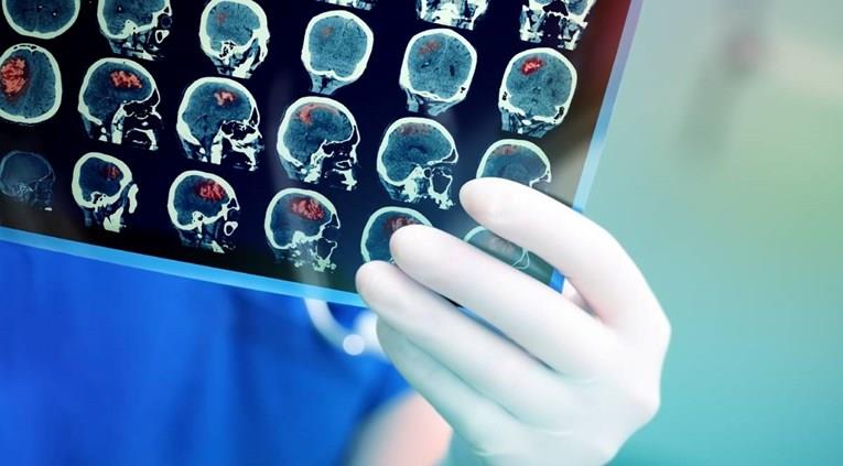 Историски успех: 13 годишно момче е излекувано од смртоносен рак на мозокот 