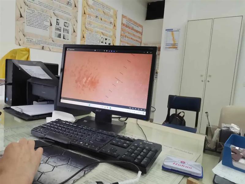 Чести самопрегледи и заштита од сонце, советуваат дерматолозите за заштита од меланом