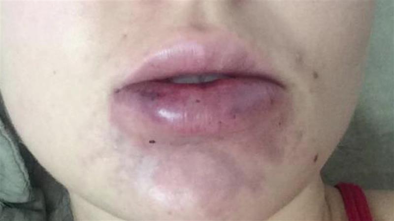 Потребна законска регулација и во доменот на естетската медицина за да се спречи надрилекарство