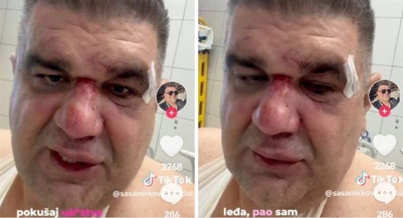 Се огласи претепаниот српски бизнисмен во Загреб: Ме тепаше менаџерот на Цеца (ВИДЕО)