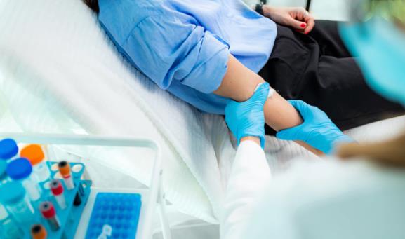 Покачениот холестерол се гледа на кожата и околу очите, а еве како да го „исчистите“