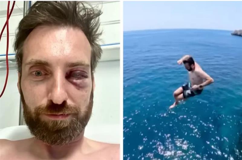 Не го правете ова на море- ризикот е огромен, советува блогер со скршен нос, очни дупки и ребра (ВИДЕО)