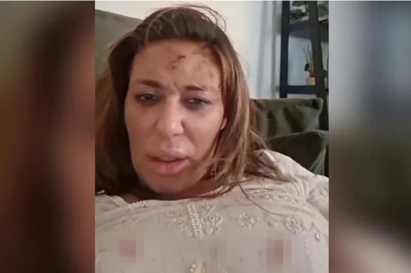 Ана Николиќ претепана од нејзиниот партнер, српската пејачка објави шокантна снимка (ВИДЕО)