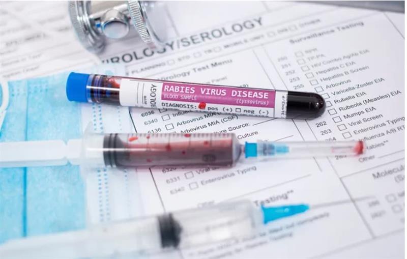 Нагло е зголемен бројот на смртни случаи поради беснило- ЦДЦ следи 15 жаришта 