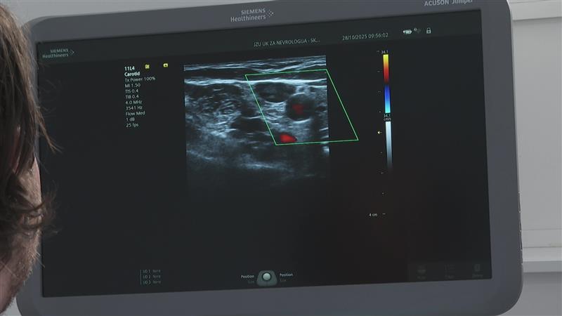 Годишно во Македонија има по пет илјади мозочни удари – не се поштедени ниту децата