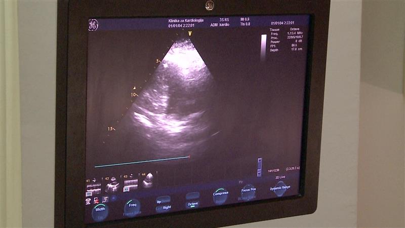 Кардиолозите предупредуваат за умерено конзумирање мрсна храна и алкохол - „демне“ Коронарен божиќен синдром