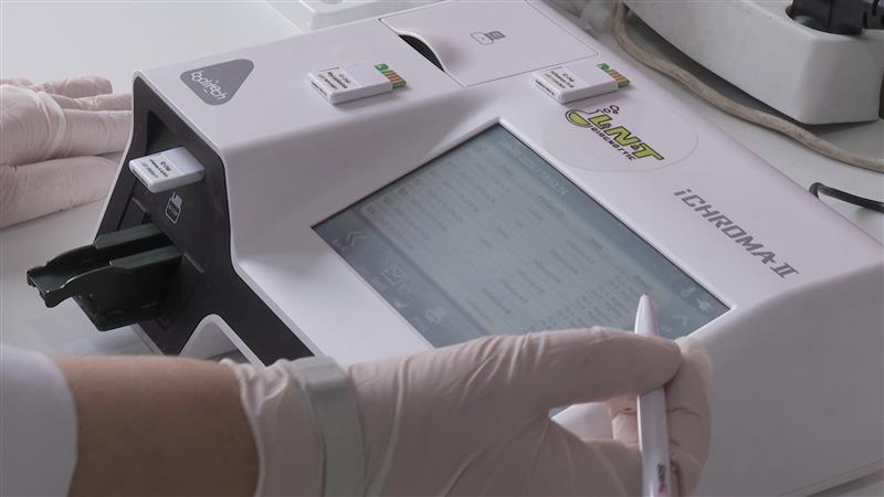35% од испитаните деца во Детската болница Козле имале грип