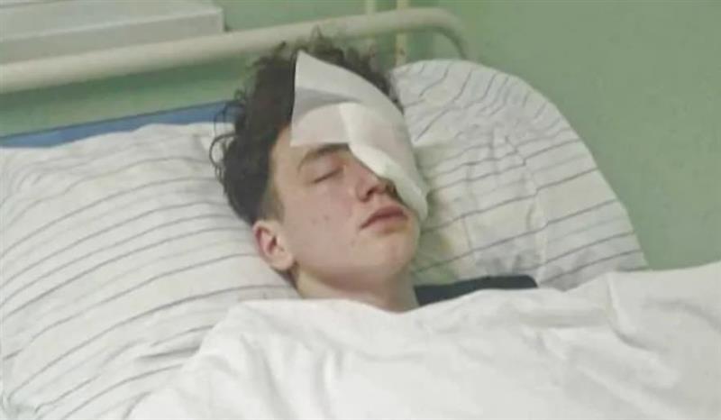 Мартин од Словачка остана без око и прсти поради петарда: Наеднаш почнаа да ми викаат дека немам палец! 