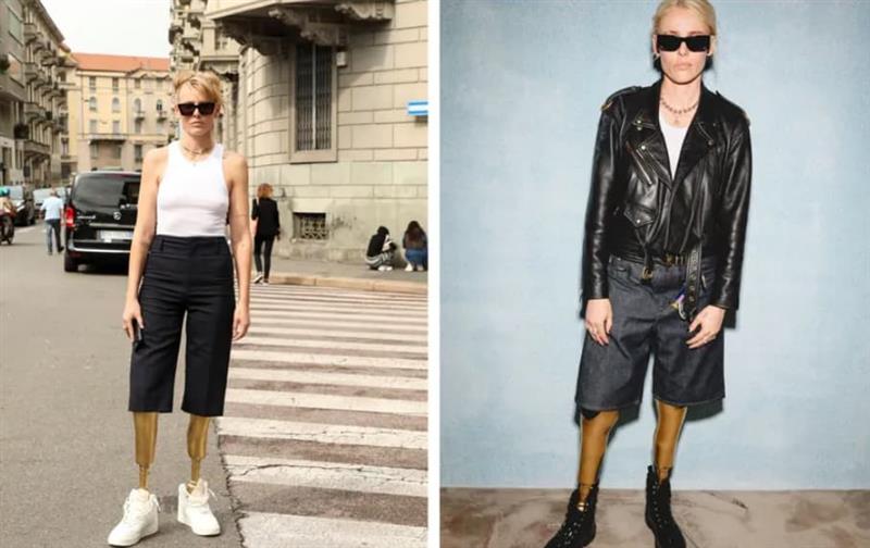 Манекенка на златни нозе: Неднаш ѝ се слошило на роденден и по неколку часа останала без двете нозе (ФОТО)