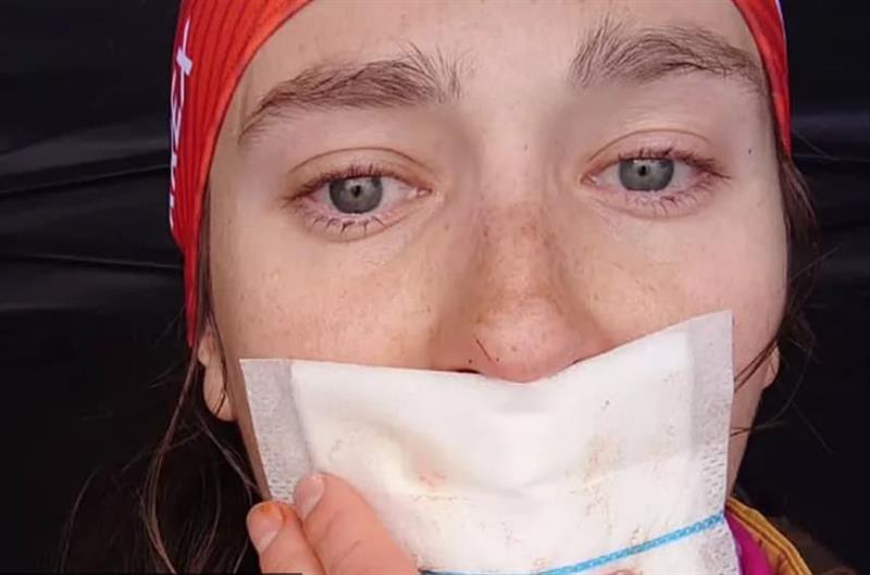 Наместо да оди на Олимписките игри, биатлонка морала да ја заврши кариерата поради трансплантација на јазик 