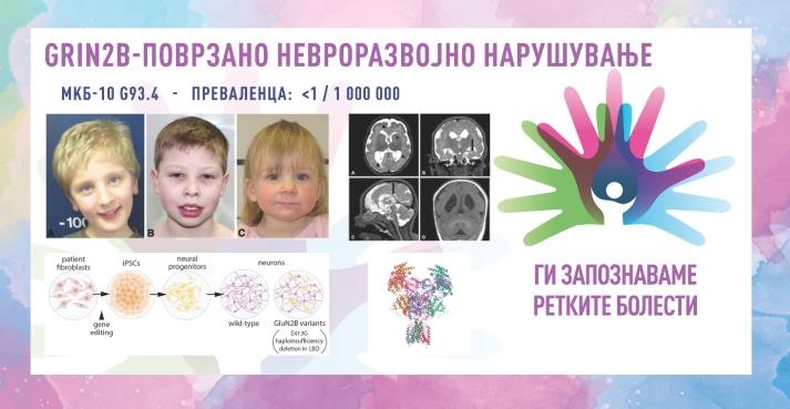 „Ги запознаваме ретките болести“: GRIN2B-поврзано невроразвојно нарушување