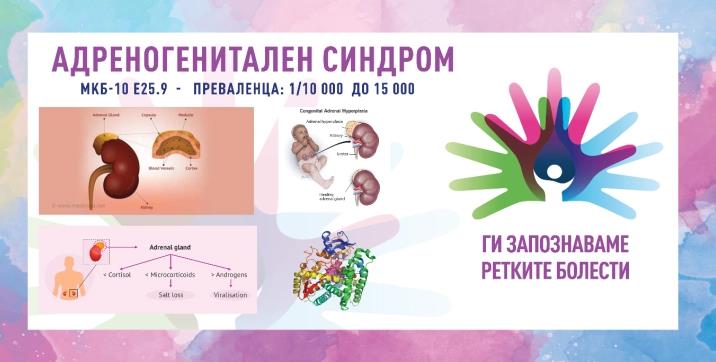 „Ги запознаваме ретките болести“: Конгенитална адренална хиперплазија