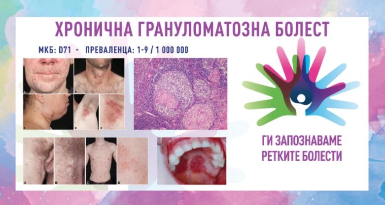 „Ги запознаваме ретките болести“: Хронична грануломатозна болест