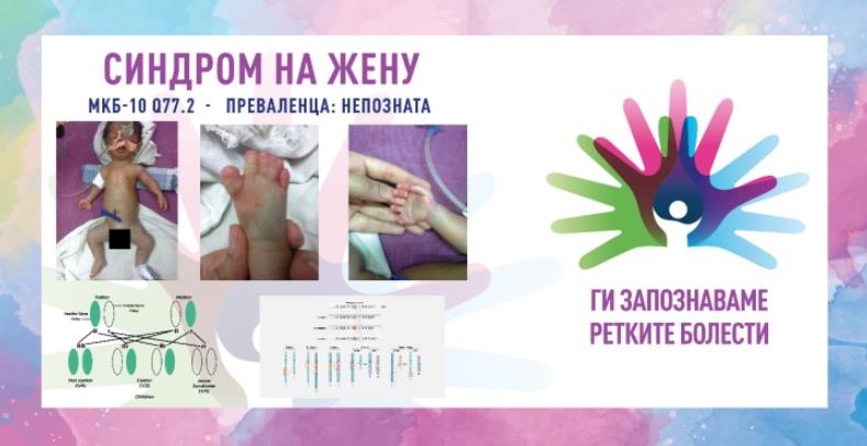„Ги запознаваме ретките болести“: Синдром на жену