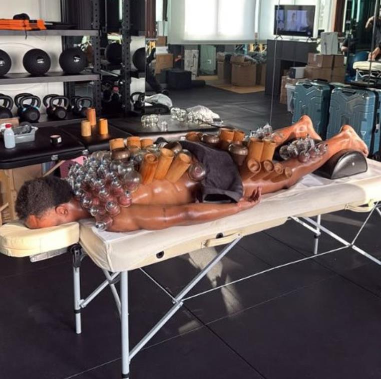 Фото: Вака, ѕвезда на Јувентус се рехабилитира по тежок меч