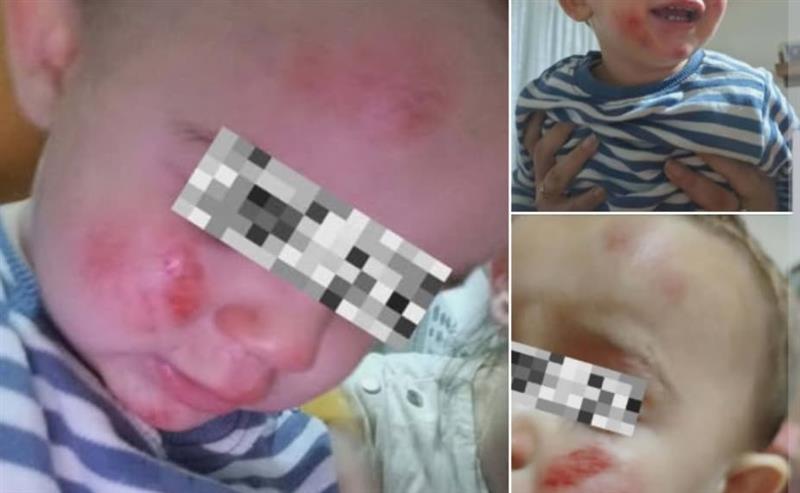 Потресно сведоштво на мајка: Агресивни кучиња ми ги нападнаа децата (ФОТО)