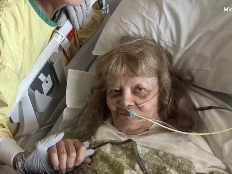 Жена од Аризона заспала на сонце, едвај преживеала
