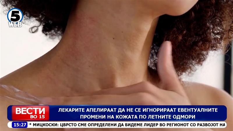Лекарите апелираат да не се игнорираат евентуалните промени на кожата по летните одмори