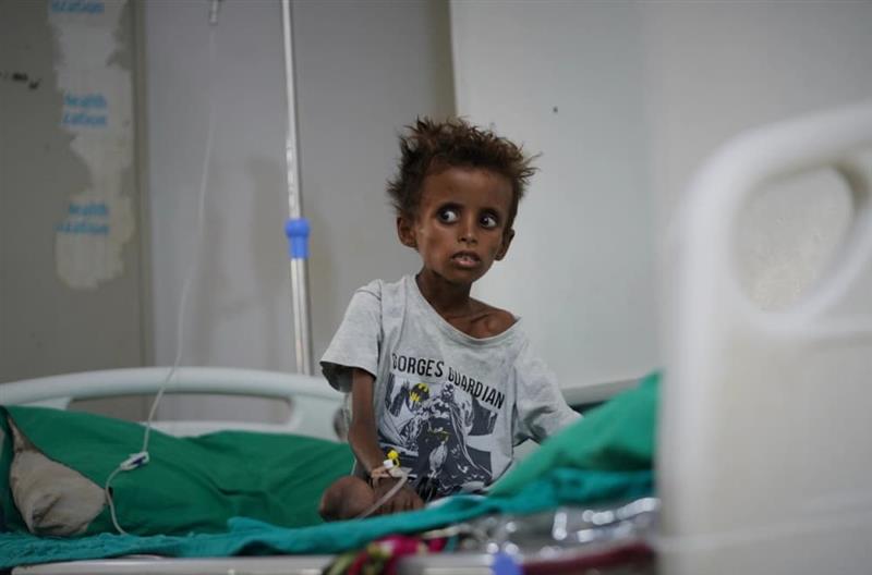 „WFP“: Гладот ​​се влошува